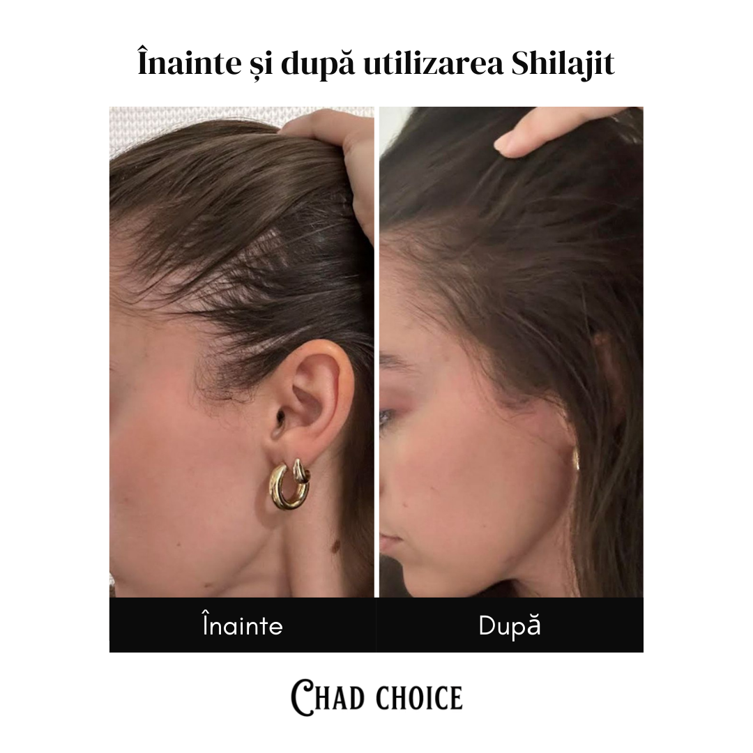 Shilajit┃Supliment Pentru Păr Premium